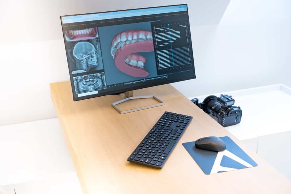showing on computer dental xray